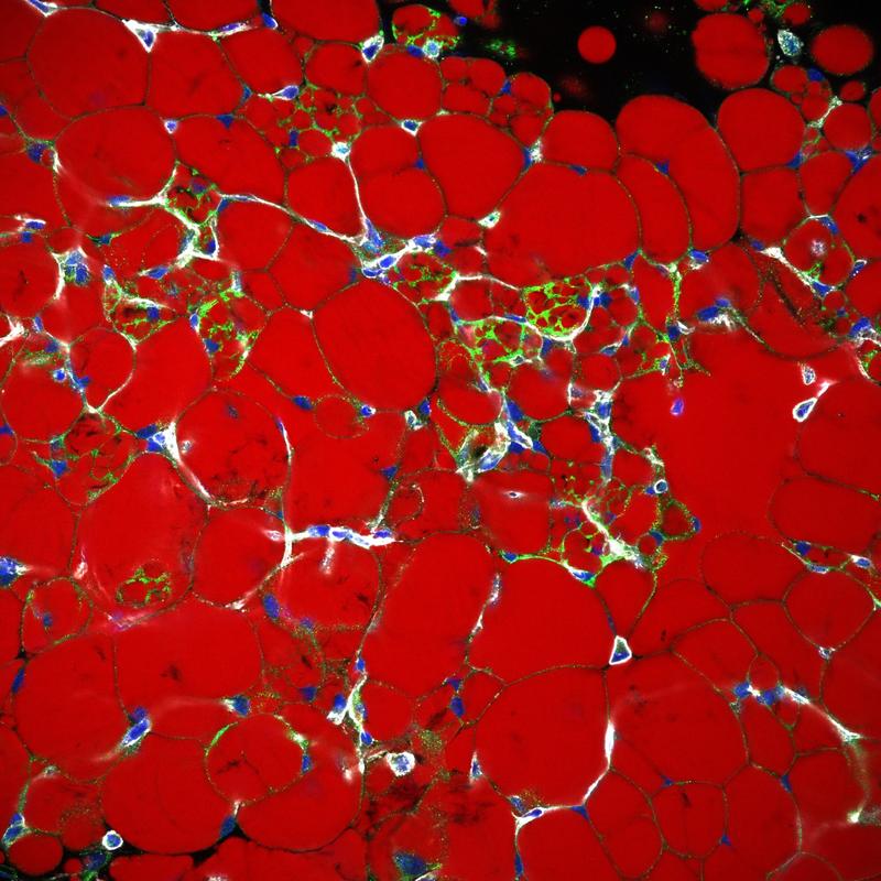 Beige Fettzellen im weißen Fettgewebe.  (Beige Fettzellen mit UCP-1 in grün gefärbt. Lipide sind rot und F-Actin, das die Zellen und insbesondere die Blutgefäße umrandet, grau, DNA ist blau)