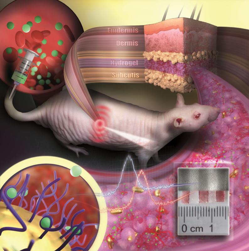 Gold nanoparticles embedded in a porous hydrogel can be implanted under the skin and used as medical sensors. The sensor is like an invisible tattoo revealing concentration changes of substances in the blood by color change.