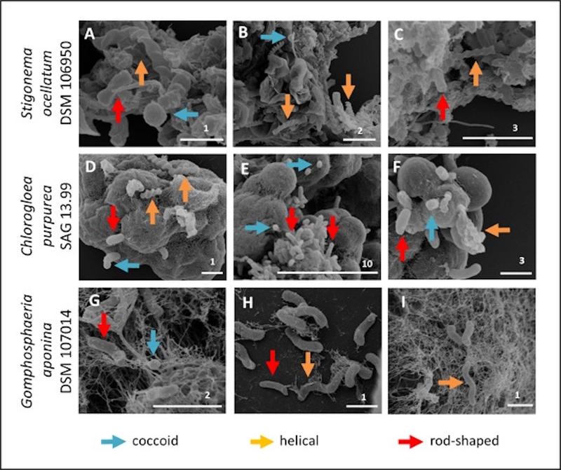 Scanning electron microscopy of three non-axenic cyanobacteria. Some coccoid, helical and rod-shaped bacteria are highlighted by arrows. (HZI/M. Rohde & DSMZ/J. Petersen)