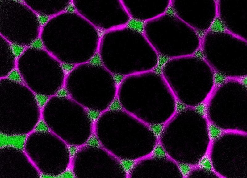 Forscher fanden heraus, dass Epithelzellen an Kontaktstellen von je drei Zellen kontrolliert ihre Verbindungen lösen, so dass Stoffe durch die Zellzwischenräume (grün) transportiert werden können.