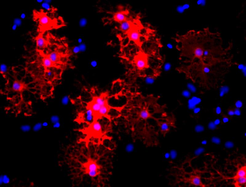 Reife Oligodendrozyten (roter Marker: Myelin-Basisches Protein) in einer in vitro Kultur. Sie differenzierten sich aus induzierten Oligodendrozyten-Vorläuferzellen (iOPC), die wiederum aus Perizyten entstanden sind (blau: Zellkerne)