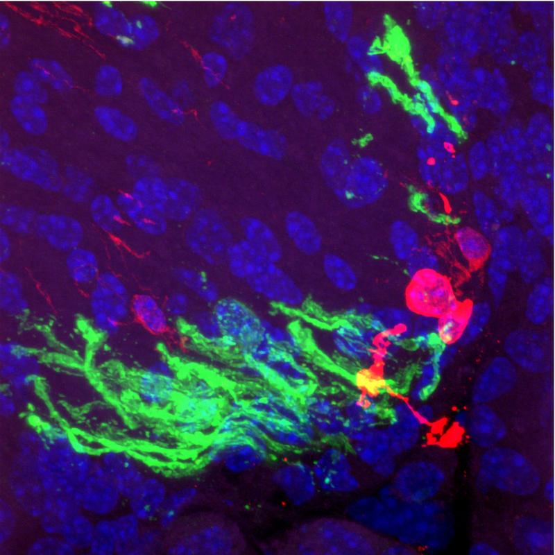 In vivo-Myelinisierung nach Transplantation von vordifferenzierten Prä-Oligodendrozyten (grün: Myelin-Basisches Protein, MBP; rot: Zellen, die von iOPC abstammen, blau: Zellkerne)