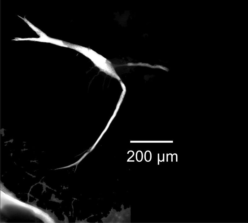 Mikroskopische Aufnahme der Mauthnerzelle eines Goldfisches (Maßstabbalken: 200 Mikrometer entsprechen 0,2 Millimeter). Durch Neurobiotin/Streptavidin-Cy3 wurde die Zelle sichtbar gemacht.
