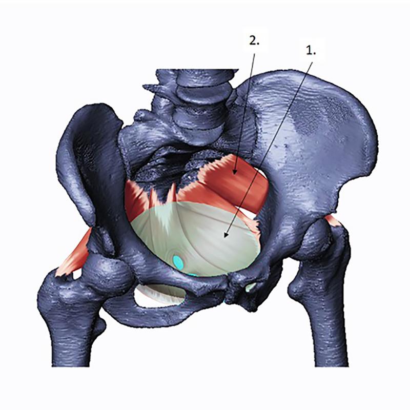 A human pelvis and muscles of the pelvic floor, which span the bony pelvic canal. The model (“1”) used in the analysis is shown superimposed on the pelvic floor muscles (“2”). (Author: Theresia Steinkellner, Copyright: Katya Stansfield.)