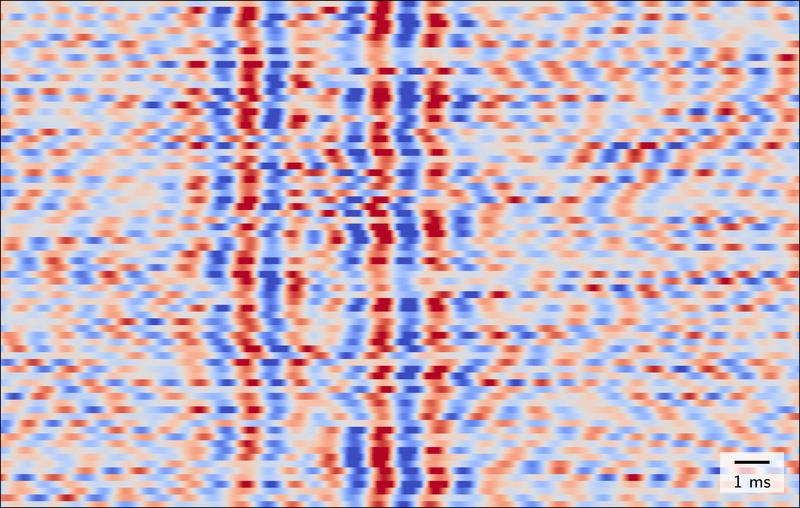 Nichtinvasiv gemessene schnelle Hirnströme zeigen eine Variabilität von Reiz zu Reiz (Zeilen), sowohl in der zeitlichen Abfolge der Aktionspotenziale (Verschiebungen der blauen bzw. roten vertikalen Banden) als auch in ihrer Stärke (Farbintensität)