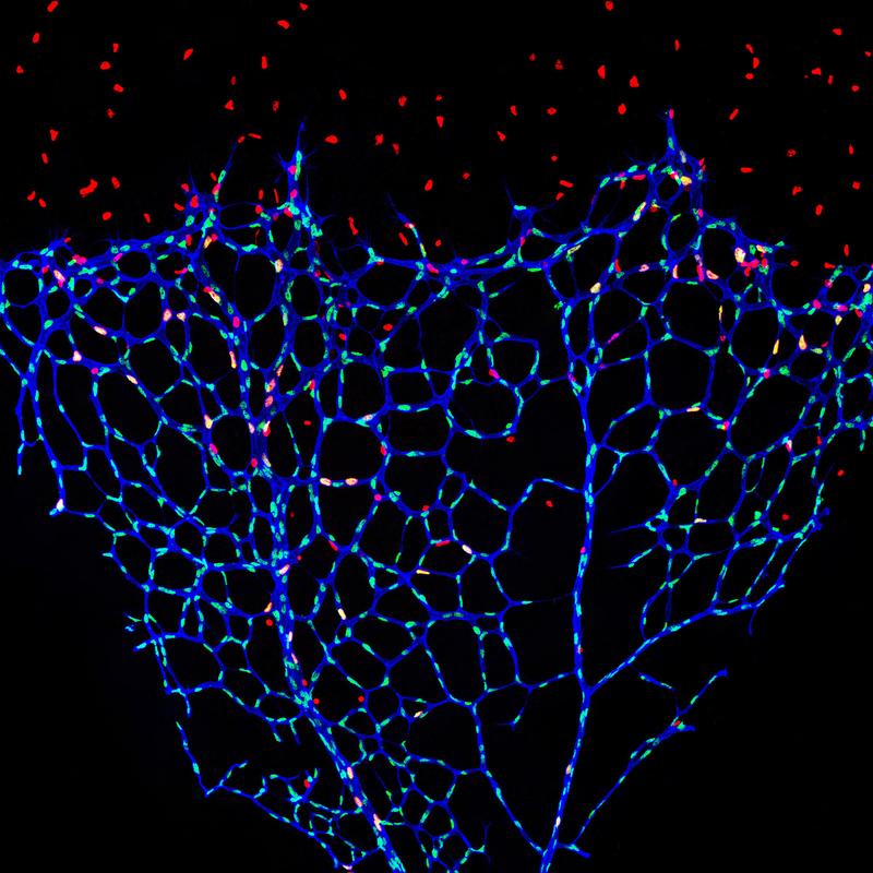 Restricted blood vessel growth due to S-2-hydroxyglutarate.