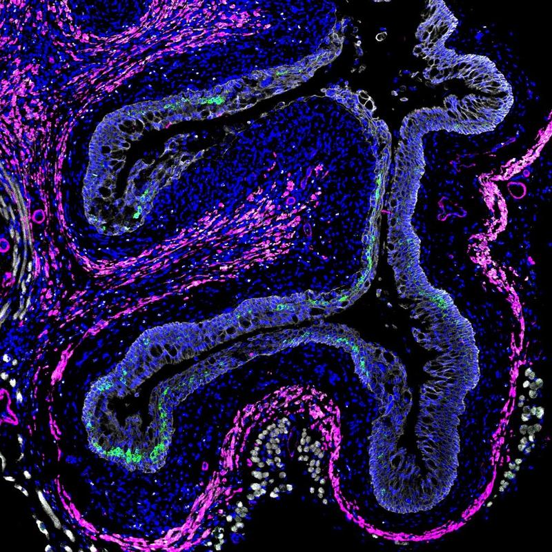 Section from the genital tract of a female mouse. The immune messenger Interleukin-33 indirectly ensures the maturation of granulocytes.