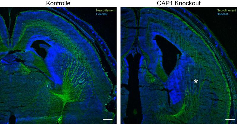 Schaltet man das Protein CAP1 aus (Bild rechts), so bilden sich im Gehirn weniger Nervenfasern (grün gefärbt) als normalerweise (Bild links). Das Sternchen in der mikroskopischen Aufnahme zeigt, wo Nervenfasern fehlen. 