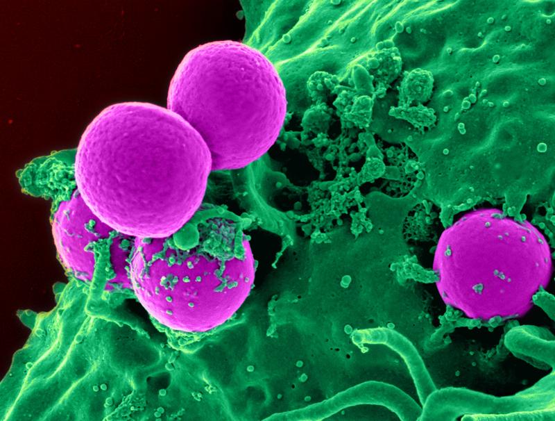 Wo herkömmliche Medikamente versagen: Antibiotika-resistente Bakterien. Kolorierte elektronenmikroskopische Aufnahme. 