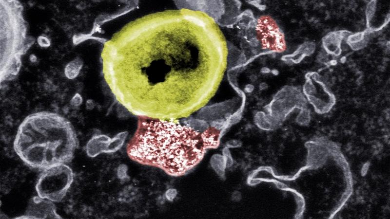 Tödlicher Kontakt: Forschende der Empa und der ETH Zürich haben Nanopartikel (rot) entwickelt, die resistente Bakterien (gelb) abtöten können.