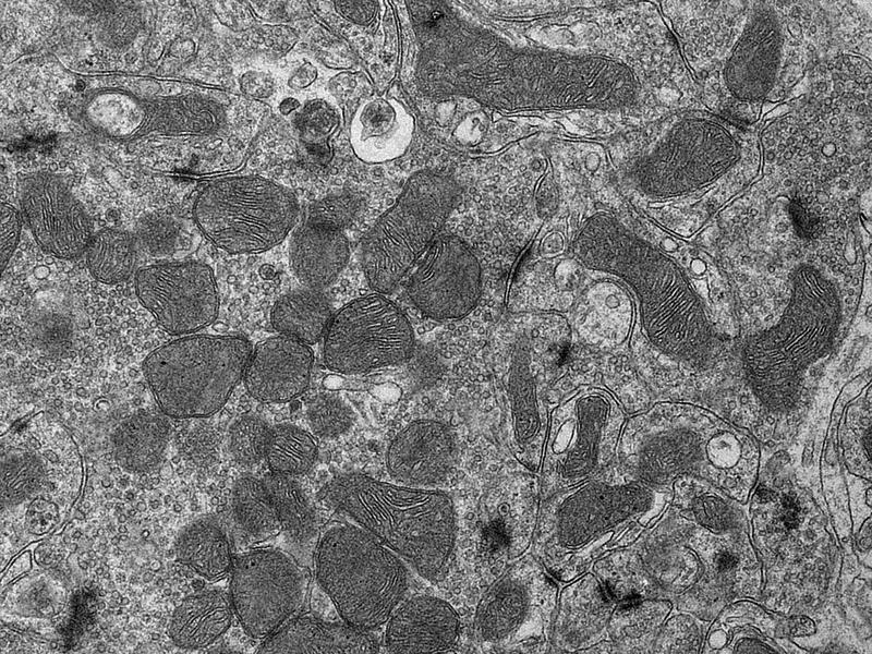 Electron micrograph of mitochondria in a nerve cell.