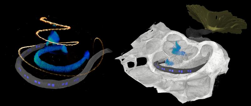Left: 3D microscopic image of an optical LED-based cochlear implant (blue LEDs in gray silicone encapsulation) with hair cells (orange) and auditory nerve (blue/green) in the cochlea of a common marmoset. Right: oCI in the basal turn 