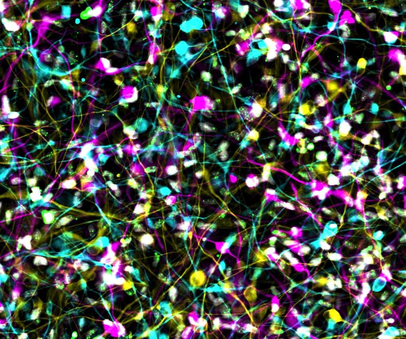 Die Abbildung zeigt induzierte Neuronen von Alzheimer-Patient*innen aus einer Immunfluoreszenz-Aufnahme. Die DNA-Schädigungen in diesen Nervenzellen sind durch grüne Punkte sichtbar.  