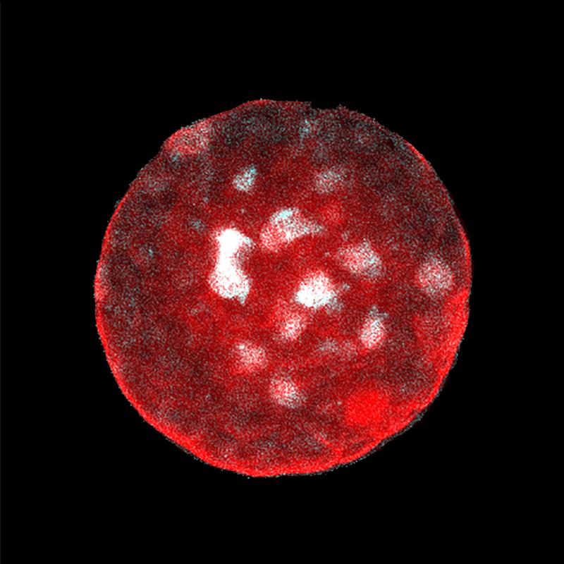 Dieser 3D-Tumoroid, gewachsen aus einer einzelnen menschlichen Krebszelle, kann den Forscher*innen dabei helfen, die physikalischen Prinzipien der Tumorevolution besser zu verstehen.