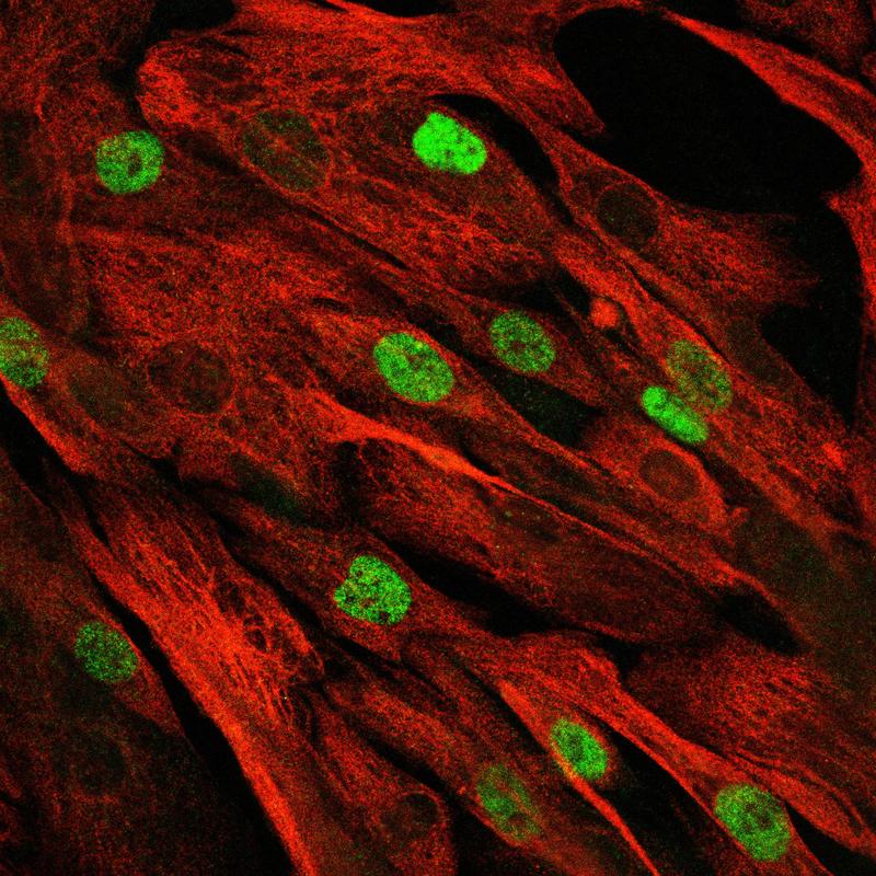 Das konfokale Mikroskopbild zeigt die primären Muskelstammzellen des Patienten, die sich nach Reparatur der Mutation mittels "base editing" weiter vermehrt haben. 