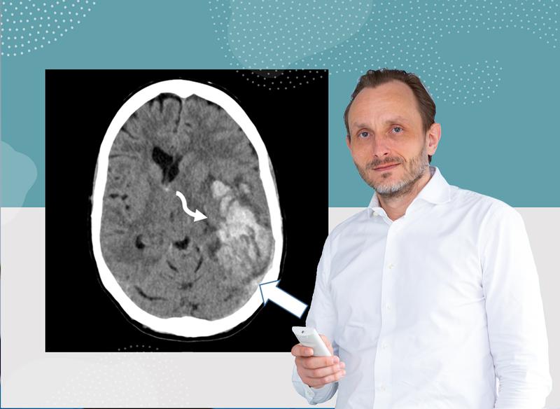 Professor Dr. Andreas Tiede mit der computertomographischen Aufnahme einer VITT-Patientin. Der weiße Pfeil deutet auf eine Hirnthrombose (hellgrau)