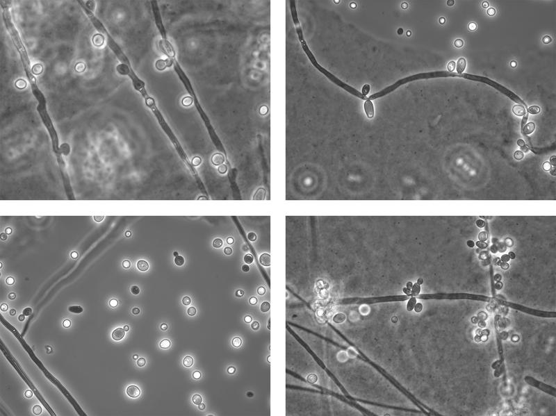 Lichtmikroskopische Bilder des Hefepilzes Candida albicans (DSM 1386)