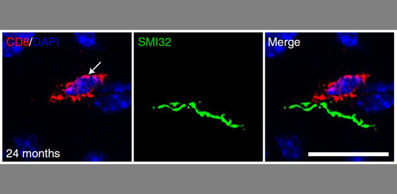 CD8+ T-Zelle (rot) im ZNS einer zwei Jahre alten Maus. Die Zelle befindet sich in unmittelbarer Nähe zu einer geschädigten Nervenfaser (grün). Zellkerne sind blau gefärbt. Maßstab: 20 µm. 