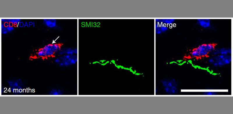 Microscopic picture of a CD8+ T cell (red) in the CNS of a two-year-old mouse. The T cell is located in immediate proximity to a damaged nerve fiber (green). The cell nuclei are labelled in blue. Scale bar: 20 µm.