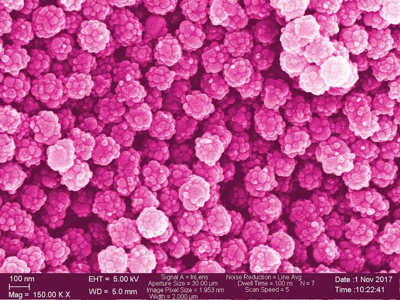 Zum Fürchten schön? Nanoplastik, elektronenmikroskopische Aufnahme, nachkoloriert, 150.000-fache Vergrösserung.