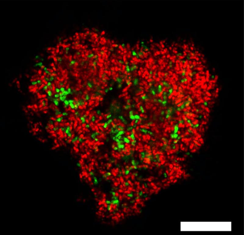 Microbial consortia of anaerobic methane oxidizing archaea stained in red and their sulfate-reducing partner bacteria stained in green. The white scale bar marks 10 µm. 