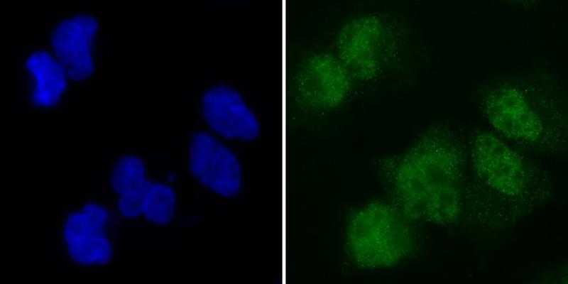 Reif durch die Insel: Wie Färbeexperimente zeigen, befindet sich SAMD1 (grün) in den Kernen (blau) von Säugetierzellen. Dort koppelt es an CG-Inseln, was die Reifung von Stammzellen beeinflussen kann. 