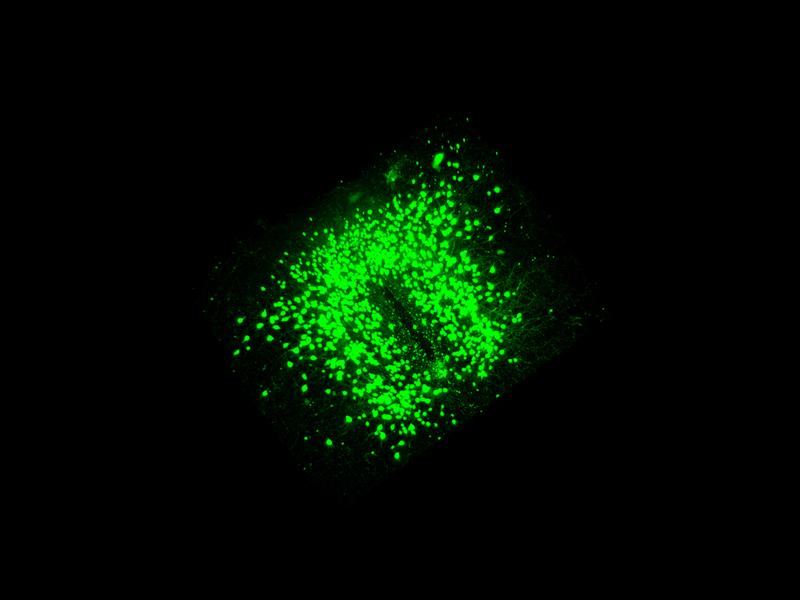 3D-Darstellung von POMC-Neuronen im Hypothalamus