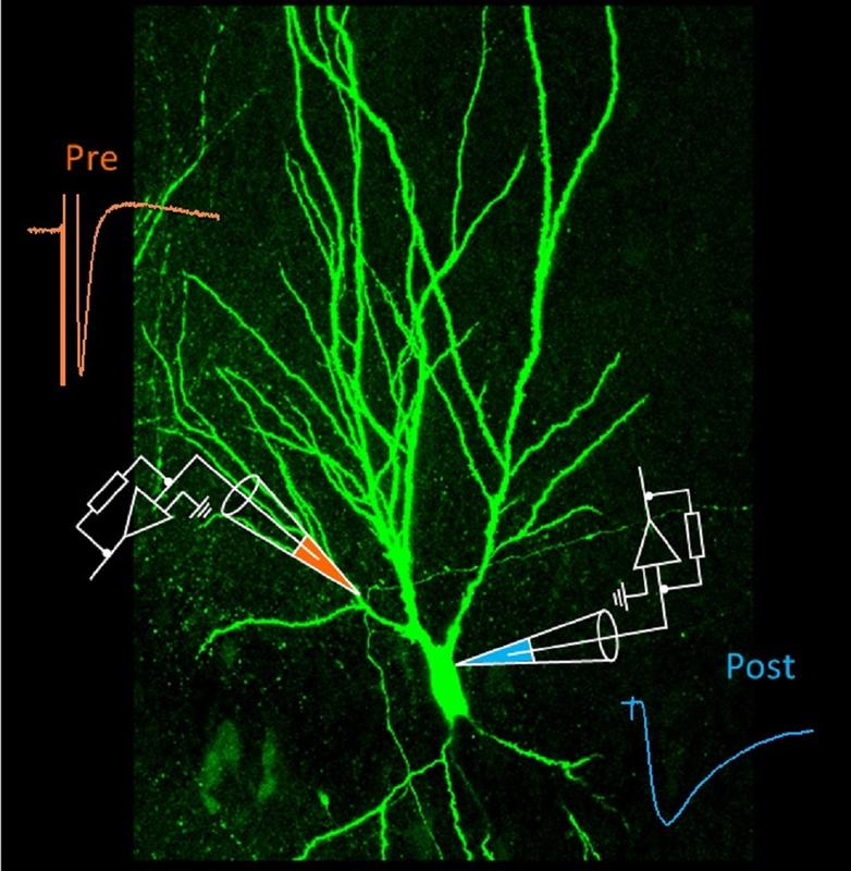 Mossy fiber synapse in the hippocampus, a “smart teacher”.  Image provided by David Vandael and Yuji Okamoto, modified from Vandael et al., Nature Protocols, in press.