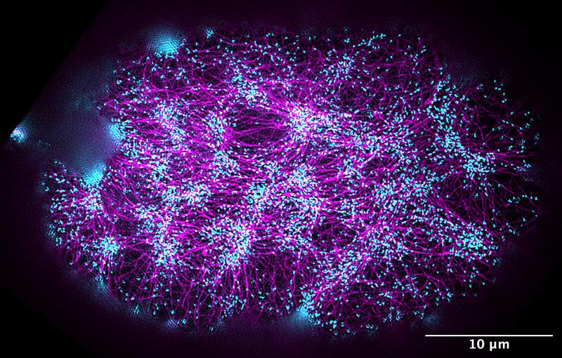 Super-resolution fluorescence image of the actomyosin cortex in a one-cell embryo. The actin filaments are labeled in magenta, and the regions where forces and torques are generated are labeled in cyan.