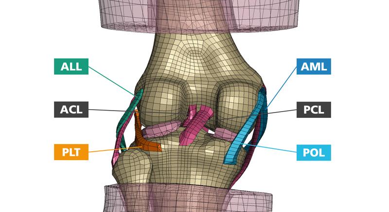 Modell des linken Knies (Rückansicht) mit den untersuchten Ligamenten: anterolaterales Ligament (ALL), vorderes Kreuzband (ACL), Popliteussehne (PLT), anteromediales Ligament (AML), hinteres Kreuzband (PCL) und das hintere Schrägband (POL).