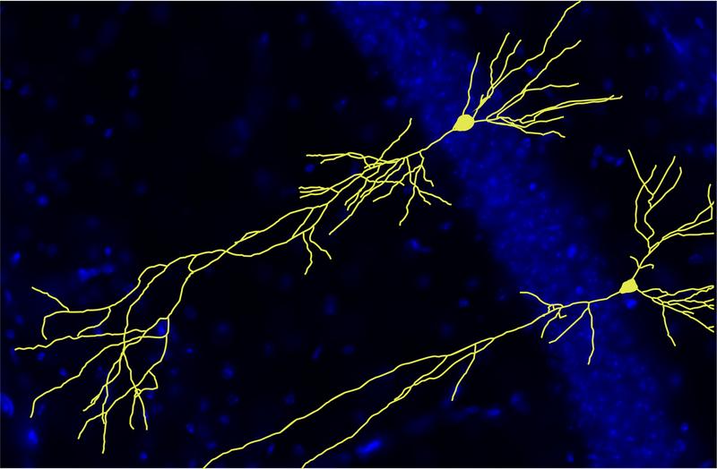 Der Verlust der APP-Familie führt zu einer veränderten Position von Nervenzellen (gelb) im Hippocampus. Nervenzellen, denen die Proteine der APP-Familie fehlen, zeigen weniger synaptische Verbindungen mit anderen Nervenzellen.
