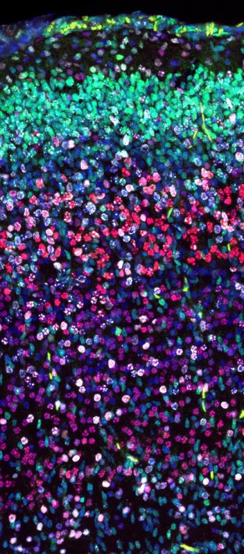 Gehirnzellen wandern langsamer: Mit der Immunfluoreszenzfärbung können die Wissenschafter_innen die wandernden Zellen (weiß) im Mäusegehirn untersuchen. 