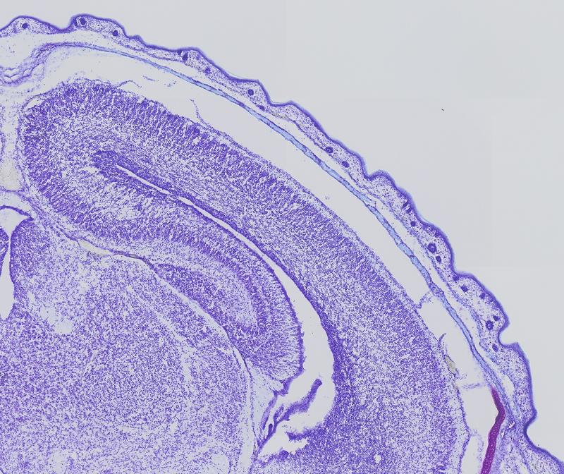 Malformations of the cortex: When analyzing the brain of the mice whose Cullin 3-Gen has been partially deactivated, the scientists found malformations of the cortex. 