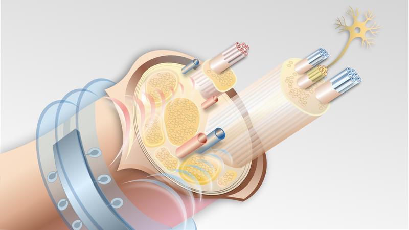 Energie für Mikroimplantate per Ultraschall. 