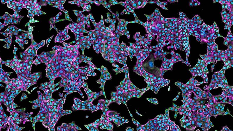 Stationärer Zustand des Zytoskeletts von Osteosarkom-Zellen (magenta: Aktin, grün:Mikrotubuli, blau: DNA)