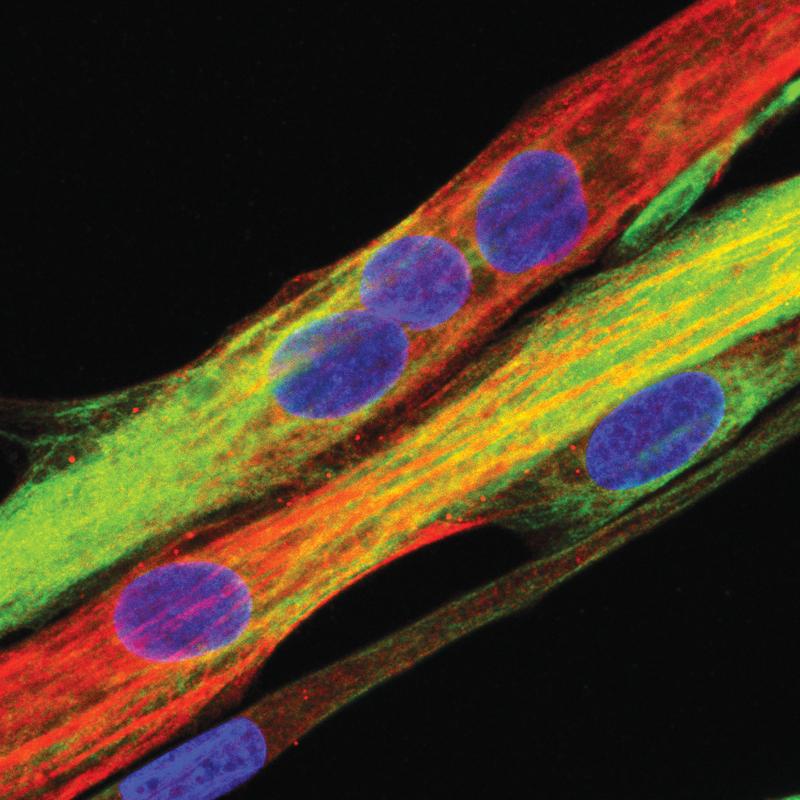 Menschliche Muskelzelle, wie sie aus Muskelstammzellen differenziert. (Blau: Zellkern, grün: Desmin, rot: Myosin Heavy Chain)