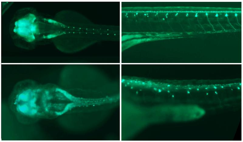 Fluoreszenzaufnahme von zwei Zebrafischembryos. Nach Ausschalten des Plexin-A1-Gens (unten) treten Fehlbildungen des Nervensystems auf, etwa eine krankhafte Vergrößerung der Nervenwasser-Räume im Gehirn (links). 