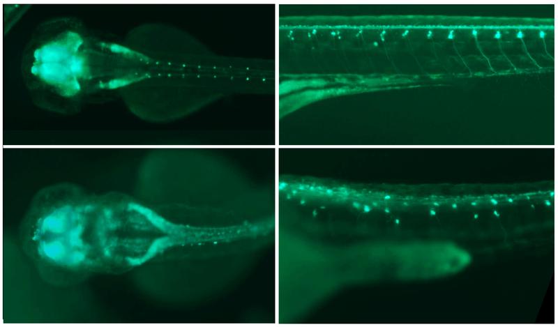 Fluorescence image of two zebrafish embryos. After switching off the Plexin-A1 gene (bottom), malformations of the nervous system occur, such as a pathological enlargement of the neural fluid spaces in the brain (left). 