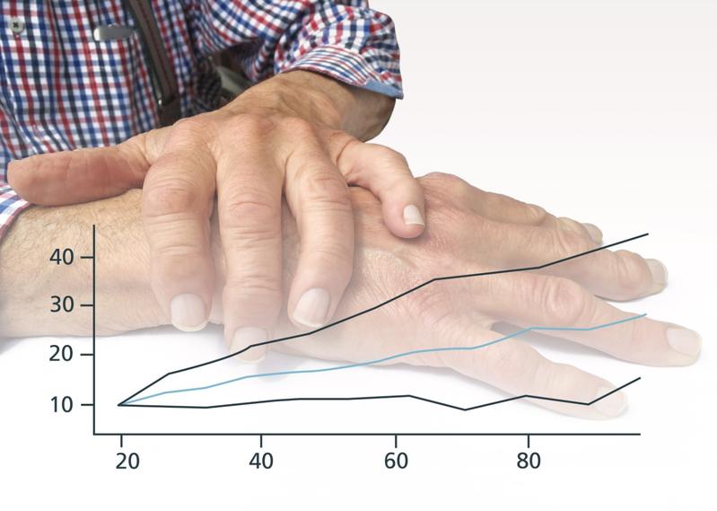 Die Parkinson-Krankheit betrifft sieben bis zehn Millionen Patientinnen und Patienten in den westlichen Gesellschaften – mit steigender Tendenz.