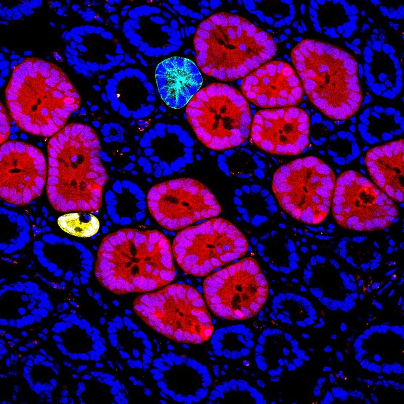 Red2Onco Confocal Microscopy