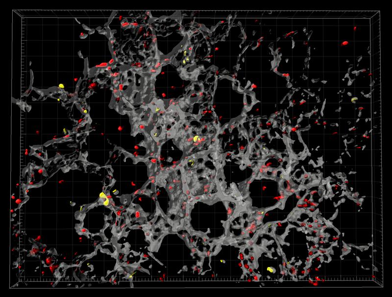 Blutplättchen (rot) interagieren in bakteriell entzündetem Lungengewebe einer Maus mit regulatorischen T-Zellen (gelb). Forscher untersuchten das lebende Gewebe mit konfokaler Fluoreszenzmikroskopie.