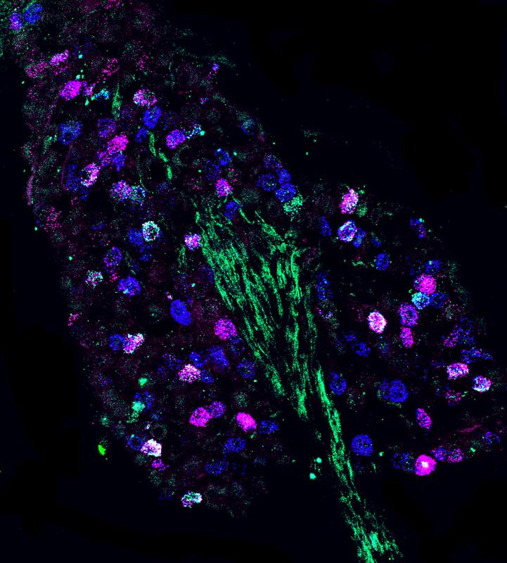 Fluoreszenzmikroskopie-Bild von genetisch unterschiedlichen Nervenzellen im Nodose Ganglion. 