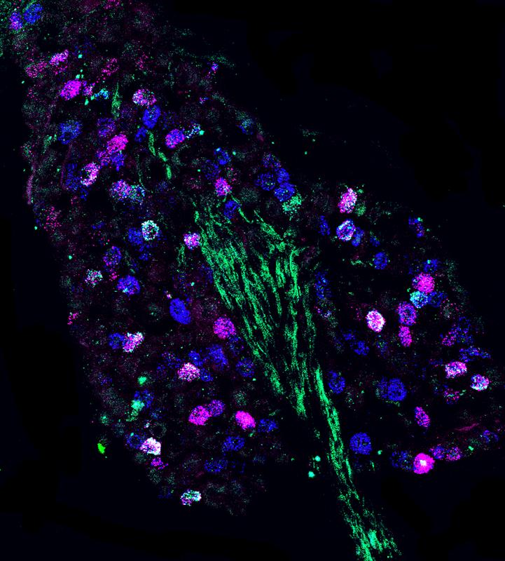 Fluorescence microscopy image of genetically distinct neurons in the nodose ganglion.