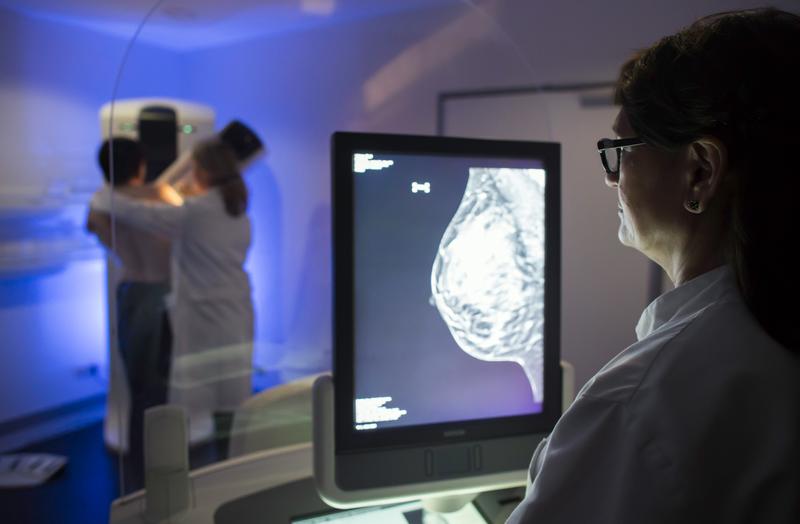 Systematische Brustkrebs-Früherkennung mit Digitaler Brust-Tomosynthese (DBT) und synthetischer 2D-Bildgebung 