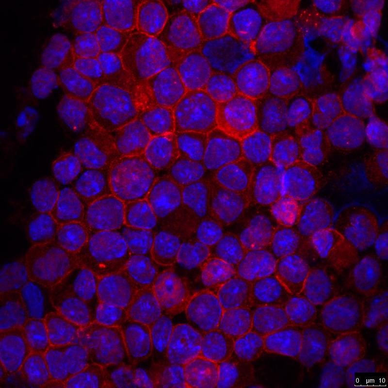Mikroskopische Ansicht tierischer Blutzellen, bei denen eine verstärkte Bildung des Proteins EVL (rot) zu erkennen ist. 