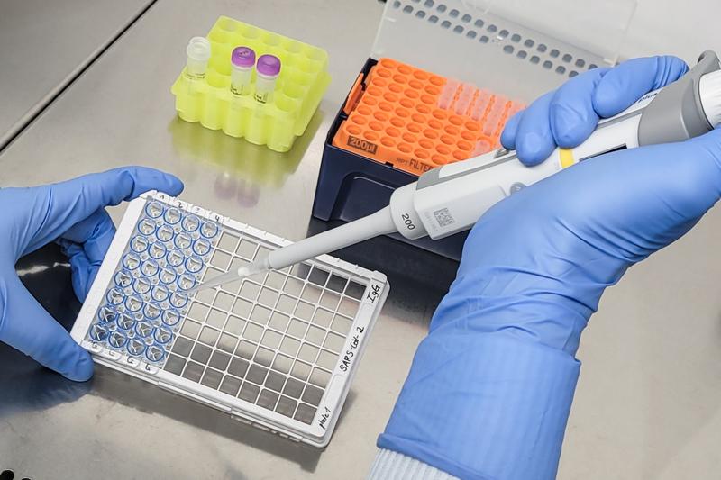 Für die Studie analysierten die Charité-Forschenden das Blut von älteren und jüngeren Impflingen auf das Vorhandensein von Antikörpern (darunter Immunglobulin G, kurz „IgG“) gegen SARS-CoV-2. 