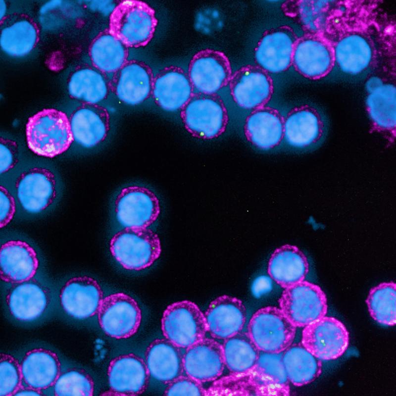 Fluoreszenzmikroskopische Aufnahme menschlicher Lymphozyten. Einige von diesen, sogenannte B-Lymphozyten, können Antikörper produzieren. 