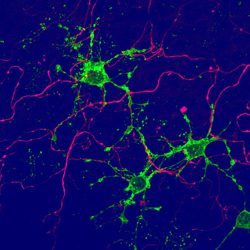 Eine neue Art von Gliazellen (grün), die aus adulten Stammzellen im Gehirn entstehen, kontaktiert Nervenzellen (magenta).