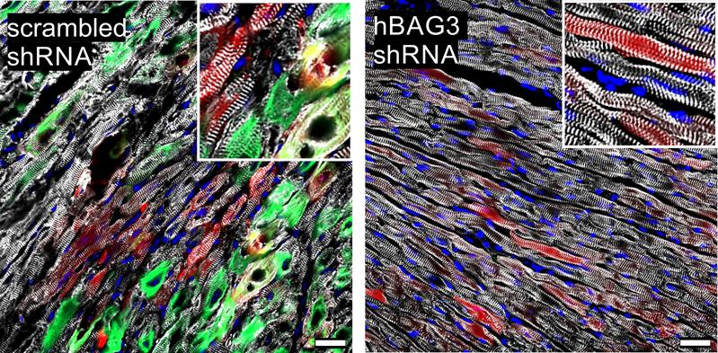 Nach einer experimentellen Therapie (rechts) zeigen sich deutlich weniger Protein-Aggregate (grün markiert) und Schäden in der Herzmuskulatur im Vergleich zu den Kontrolltieren (links).