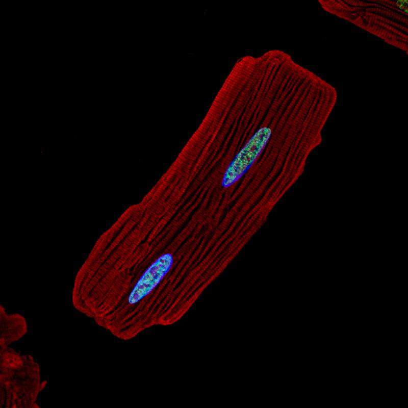 Herzmuskelzelle der Ratte: Das Protein alpha-Aktinin (rot) zeigt die periodische Struktur der Muskelfibrille. Zwei Zellkerne sind blau gefärbt. 